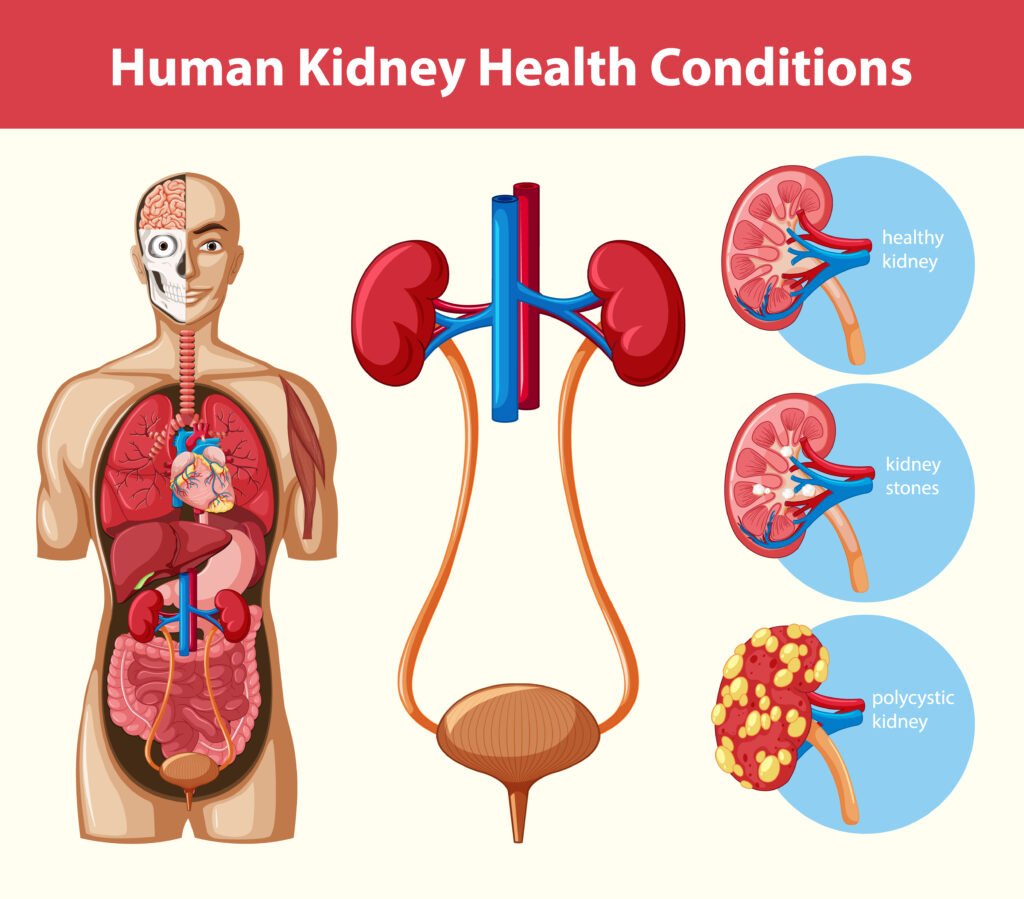 Coping with Kidney Failure: A Comprehensive Guide